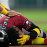 Arizona’s Perdomo leaves game with head contusion after being hit in the helmet by a line drive